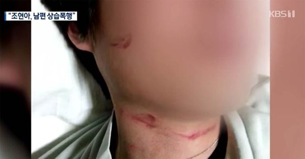 Video Allegedly Shows Korean Air 'Nut Rage' Heiress Assaulting Husband